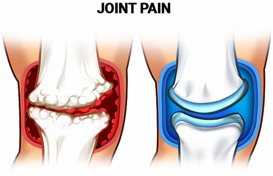 Joint lubricant to help reduce knee pain and injury